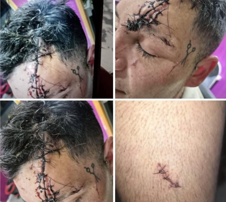 Procesaron con prisión preventiva a una mujer acusada de atacar a un hombre