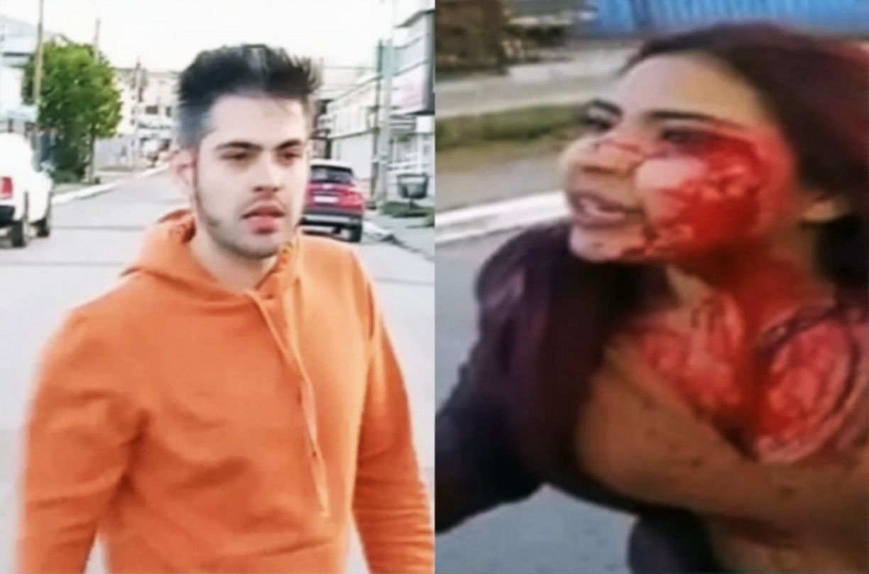 Comienza el juicio contra un hombre acusado de atacar a una mujer a botellazos en Río Grande
