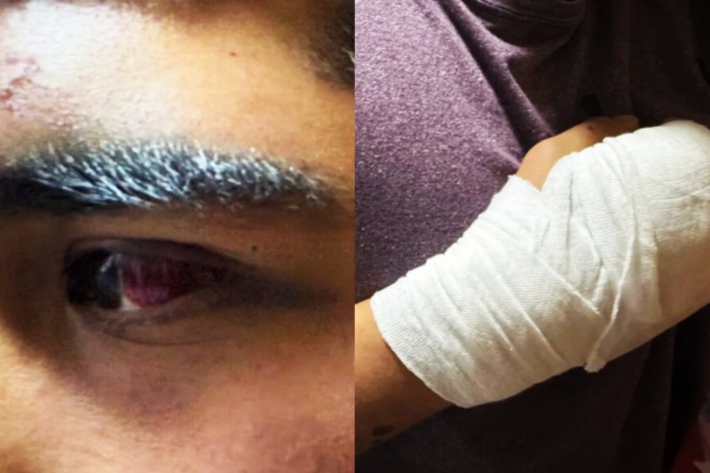 Denunció que fue golpeado durante una hora, asaltado y obligado a grabar un video bajo amenazas